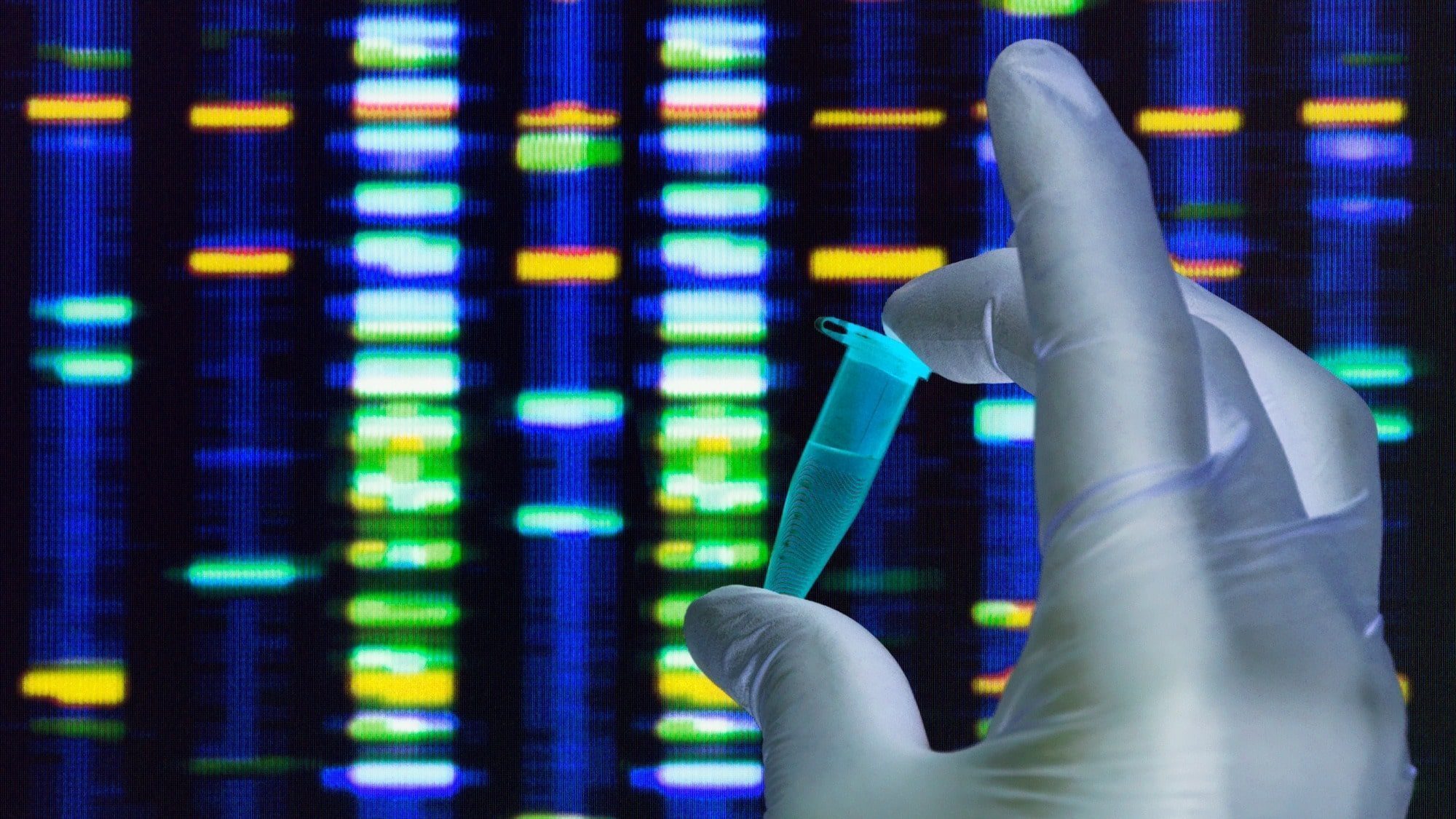 DNA and RNA are composed of the TCGA.
Four letters make your whole genomic code.
